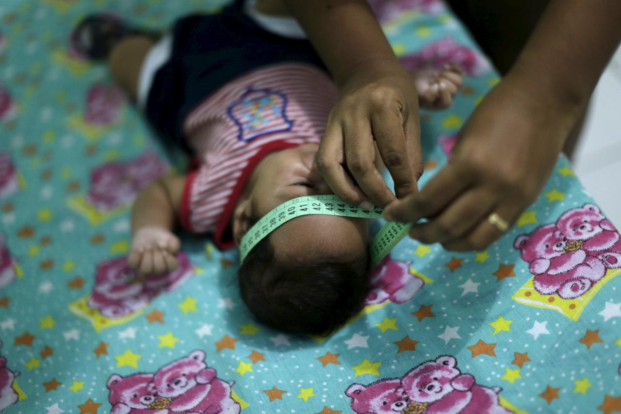 Guilherme Soares Amorim, 2 months, who was born with microcephaly, gets his head measured by his mother Germana Soares, at her house in Ipojuca, Brazil, February 1, 2016. Brazil's top health official said on Monday that the Zika virus outbreak is proving 